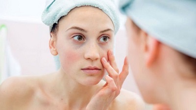 5 Tanda Tak Cocok Pakai Skin-care